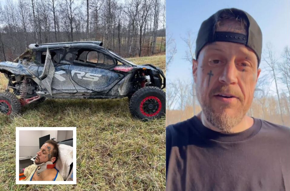 Did Jelly Roll Get Hurt? Singer Reveals Broken Collarbone After ATV Accident