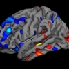 Picture of Brain